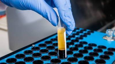 Александр Гинцбург - Главные новости за ночь: интерферон против коронавируса, пандемия половой инфекции, послабления в Британии и пятилетний прогульщик в наручниках - koronavirus.center - Англия