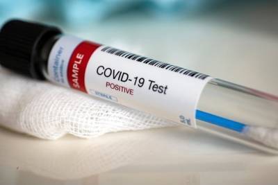 Ученые выяснили, каким образом может выделяться коронавирус - vm.ru - Англия