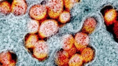 Ученые выяснили механизм влияния белков коронавируса на сосуды - iz.ru - Израиль