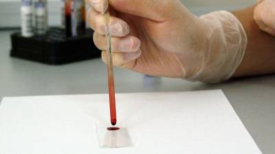 Адан Гебреисус - ВОЗ отрицает лабораторное происхождение коронавируса - politros.com - Ухань