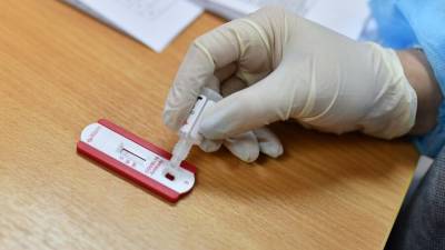 Около тысячи вакцинированных москвичей заболели коронавирусом - m24.ru - Москва