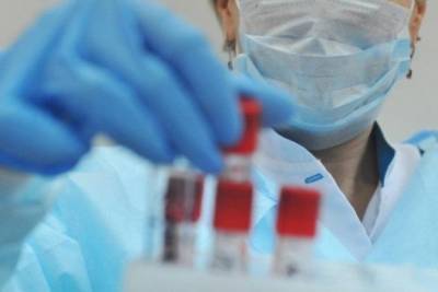 99 новых случаев заражения коронавирусом выявили в Забайкалье за сутки, всего – 39,1 тыс. - chita.ru - Забайкальский край