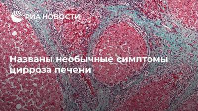 Названы необычные симптомы цирроза печени - ria.ru - Москва