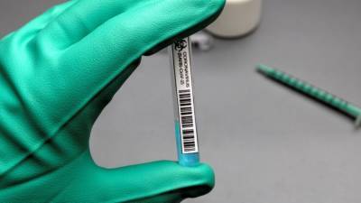 Российские медики сделали более 113 миллионов тестов на COVID-19 с начала пандемии - politros.com - Россия