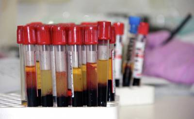Live Science (США): почему вторая группа крови повышает риск тяжелого течения covid-19? - inosmi.ru