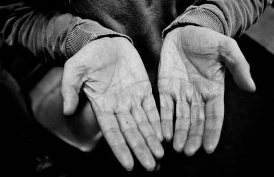 Чем мозоли на ладонях могут быть опасны для здоровья человека? - ont.by