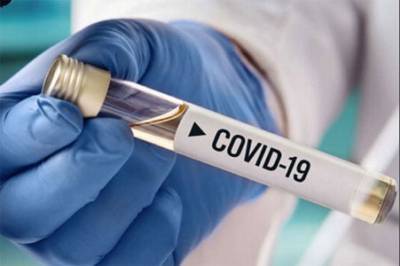 На Луганщине лабораторно подтверждено 72 новых случая COVID-19 - vchaspik.ua - Украина