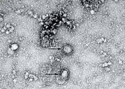 "Британский штамм" коронавируса ничем не опаснее других - исследование - nakanune.ru - Лондон