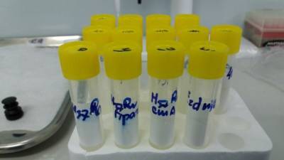 Израильские ученые создадут лекарство от COVID-19 на основе молочных продуктов - polit.info - Израиль
