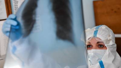 Ученые обучили нейросеть выявлять коронавирус по рентгеновским снимкам - mir24.tv - Белгород