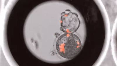 Выращенные человеческие клетки в эмбрионах обезьяны вызывают этические беспокойство у экспертов - 24tv.ua - Англия - штат Калифорния