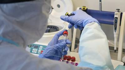 Анна Попова - В России проводят испытания кожного теста на иммунитет к COVID-19 - russian.rt.com - Россия