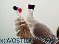 Отечественные специалисты представили свою систему поиска антител к COVID-19 - novostidnya24.ru - Россия