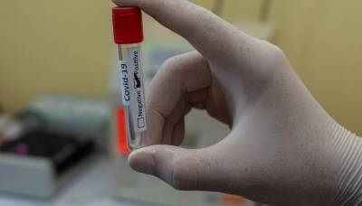 Рошель Валенски - Лишь 6 тыс. полностью вакцинированных американцев из 84 млн. заразились COVID-19 - usa.one