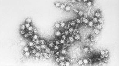 В Канаде изучили вероятность зарождения новых опасных вирусов в организме человека - nation-news.ru - Канада