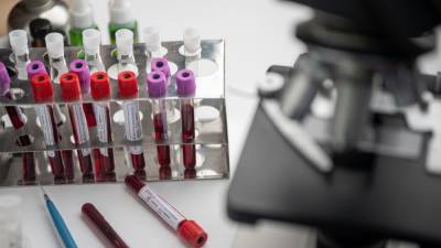 Россиянам рассказали, как действует экспресс-тест на антитела к коронавирусу - nation-news.ru - Челябинск
