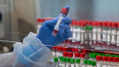 За сутки в Румынии выявили более 2200 случаев коронавируса - russian.rt.com - Румыния