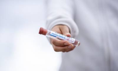 В Україні за добу 7 930 нових випадків коронавірусу - rusjev.net