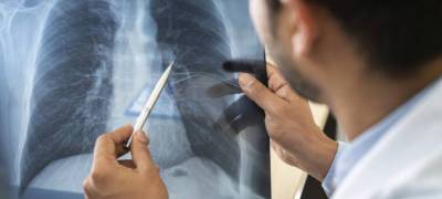 За год у 40% больных пневмонией был обнаружен коронавирус - stolicaonego.ru - республика Карелия