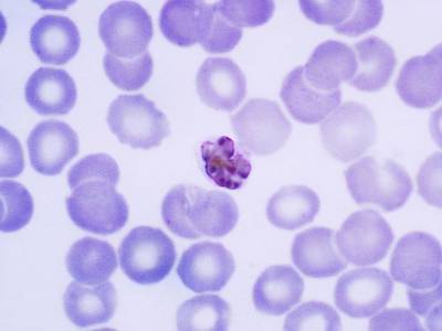 Вакцина от малярии показала обнадеживающие результаты на испытаниях - polit.ru