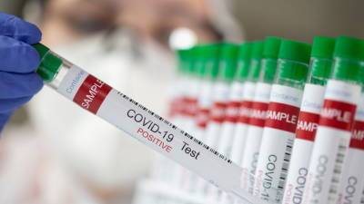 Число случаев коронавируса в Колумбии достигло 2 841 934 - russian.rt.com - Китай - Колумбия