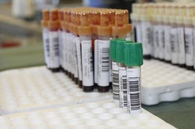 Число заражений коронавирусом в России снизилось до 8,7 тысячи за сутки - pnp.ru - Россия