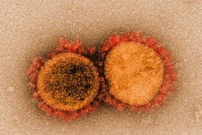 Ученые сообщили о новых способах лечения коронавируса - lenta.ru