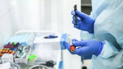 Исследование: объём продаж тестов на антитела к COVID-19 упал на 51% с начала года - russian.rt.com - Россия