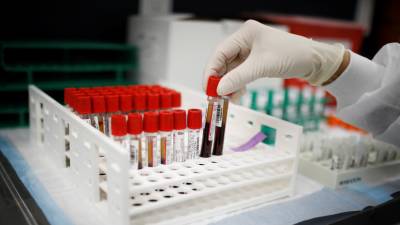 В России за сутки проведено более 250 тысяч тестов на коронавирус - russian.rt.com - Россия