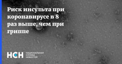 Михаил Мартынов - Риск инсульта при коронавирусе в 8 раз выше, чем при гриппе - nsn.fm