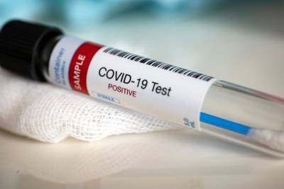 Назван многократно увеличивающий риск смерти от коронавируса симптом - vm.ru