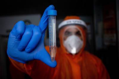 Минздрав опубликовал новую информацию об эпидемии коронавируса - nashe.orbita.co.il - Израиль - Тель-Авив - Иерусалим