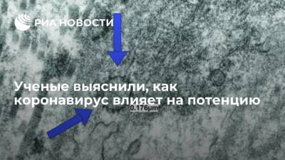 Ученые выяснили, как коронавирус влияет на потенцию - ria.ru - Москва - Сша