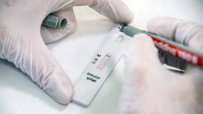 Ляшко: тесты на антитела к Covid – “маркетинговый ход” - inform.zp.ua