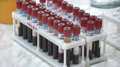 В Беларуси приступили к заготовке плазмы крови доноров, привитых от коронавируса - belarus24.by
