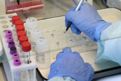 Более 550 тыс. тестов на коронавирус сделали в КЧР за время пандемии - interfax-russia.ru - республика Карачаево-Черкесия