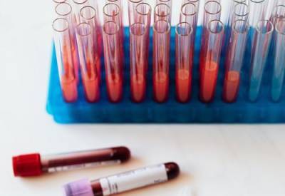 Шведские ученые нашли связь между серьезными заболеваниями и группой крови - argumenti.ru