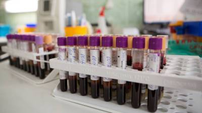 Ученые нашли связь группы крови с опасными болезнями - mir24.tv