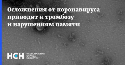 Вероника Скворцова - Осложнения от коронавируса приводят к тромбозу и нарушениям памяти - nsn.fm