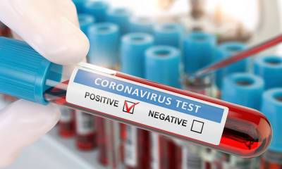 Назван новый признак, что у пациентов с коронавирусом будут осложнения - gubdaily.ru - Пресс-Служба