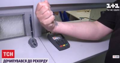 Расплатиться рукой или открыть магнитные замки: зачем киевлянину 8 чипов под кожей - tsn.ua