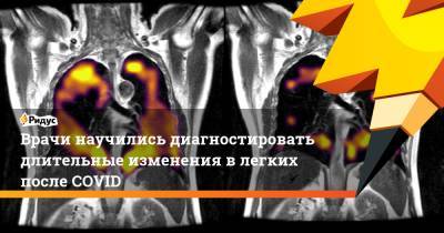Врачи научились диагностировать длительные изменения в легких после COVID - ridus.ru