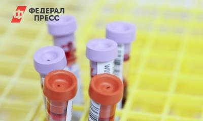 Ученые разработали тест на антитела к COVID-19 по капле крови - fedpress.ru - Швейцария