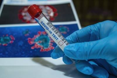 Германия: Новый тест на коронавирус может испортить путешествие - mknews.de