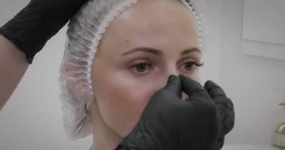 Хрящ, напечатанный на 3D-принтере, может восстановить нос после рака кожи (видео) - focus.ua - Канада