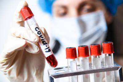 В Смоленской области провели почти 400 тысяч тестов на коронавирус - rabochy-put.ru - Смоленская обл.