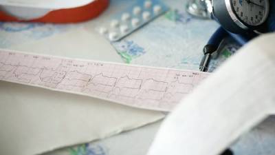 Кардиолог дал советы по питанию для снижения риска инсульта - russian.rt.com - Кемерово