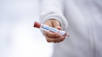 Наталья Пшеничная - Эпидемиолог заявила, что некоторые переболевшие коронавирусом жалуются на онемение конечностей - piter.tv