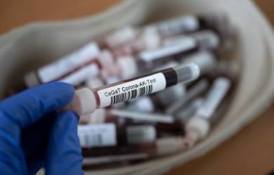 В РФ выявили максимальное с 22 февраля количество случаев заражения коронавирусом – 12 505 - argumenti.ru - Россия
