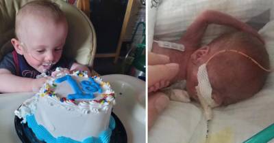 "Врачи давали 0%": самый недоношенный ребенок в мире отпраздновал первый день рождения (фото) - focus.ua - Сша - штат Миннесота
